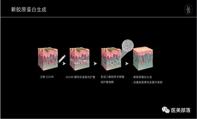 GOURI：全球首款"全液态"PCL，塑造医美抗衰"新标杆"