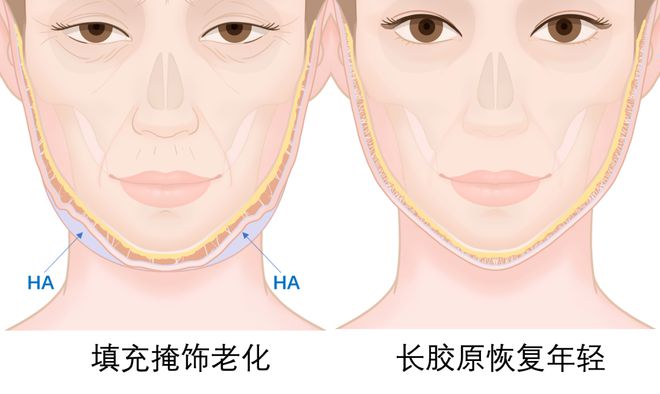 科普: 「馒化脸」​全方位解析附修复攻略